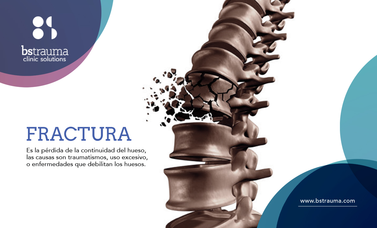 Fracturas