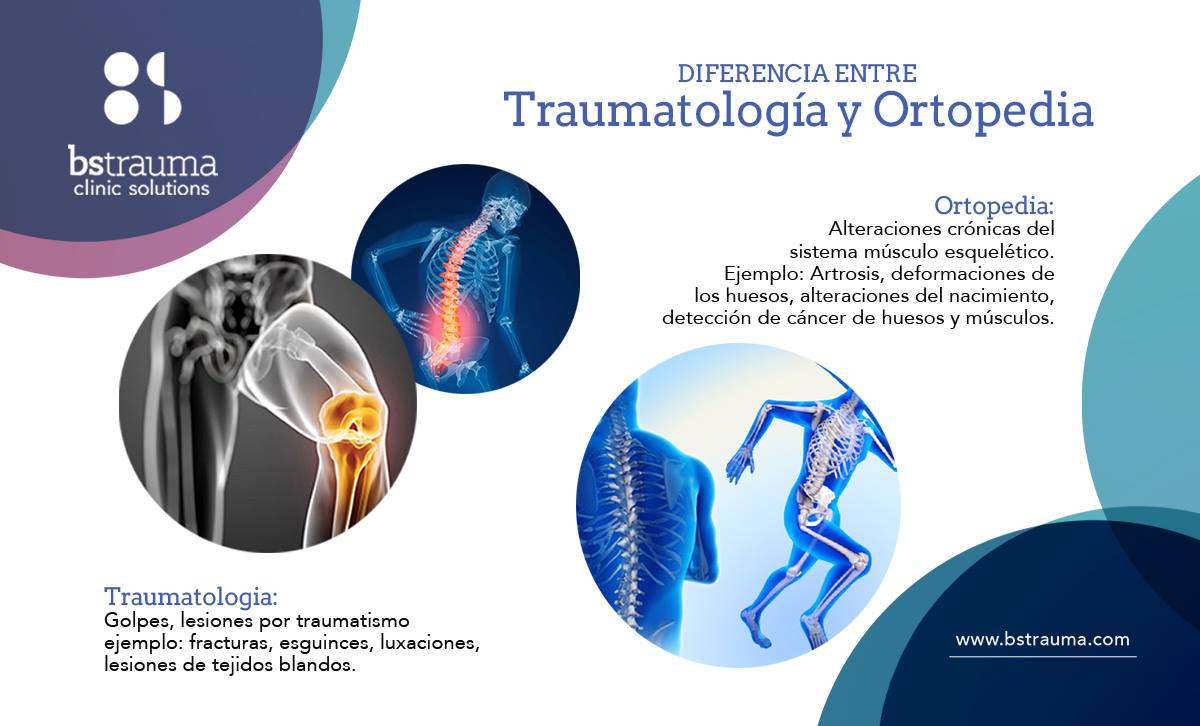 Diferencia entre Traumatología y Ortopedia
