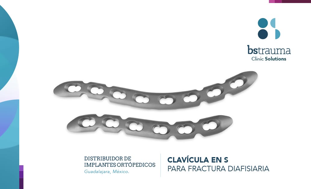 Clavícula Fractura Diafisiaria