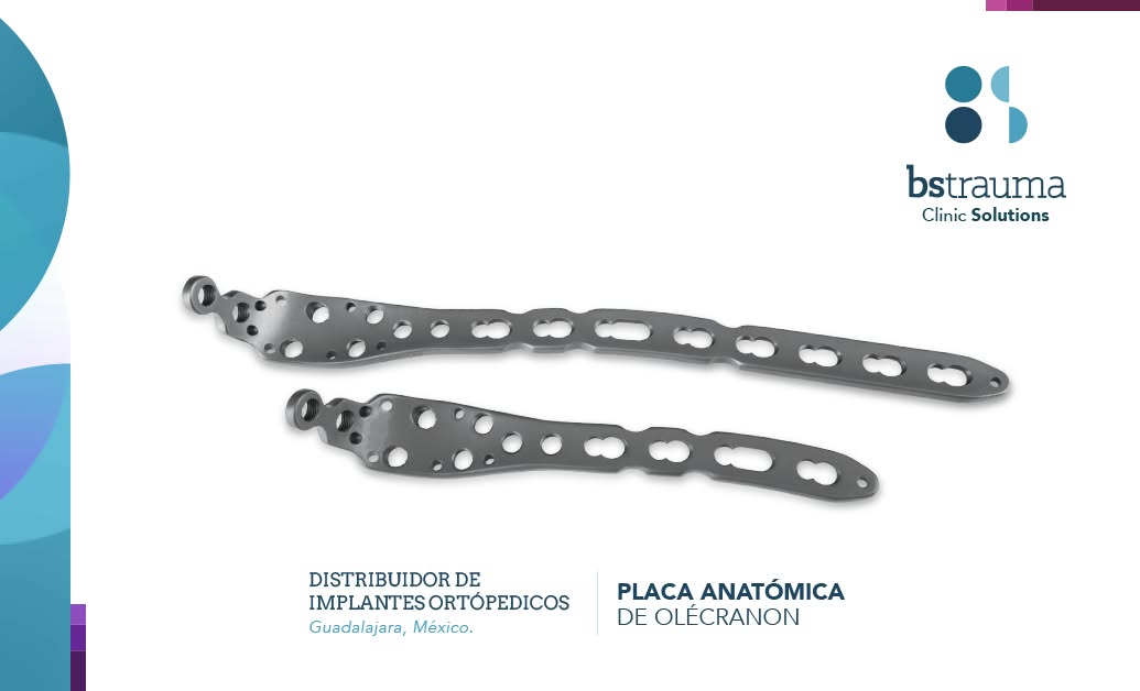 Placa Anatómica Olécranon